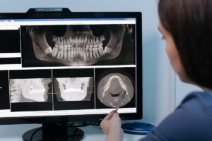رادیوگرافی دندان - تکنو دندان